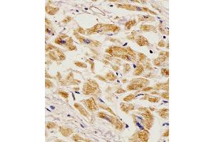 Antibody staining EGF in Human heart tissue sections by Immunohistochemistry (IHC-P - paraformaldehyde-fixed, paraffin-embedded sections). (EGF anticorps  (AA 690-720))