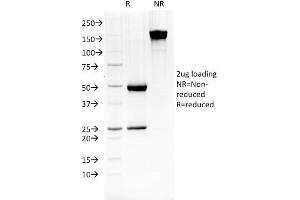 SDS-PAGE Analysis of Purified HSP27 MAb (G3.
