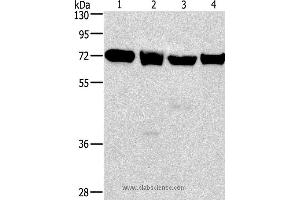 Western blot analysis of 231, 293T, Raji and hela cell, using IL2RB Polyclonal Antibody at dilution of 1:325 (IL2 Receptor beta anticorps)