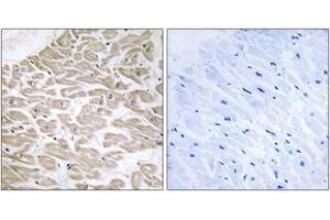 Immunohistochemistry (IHC) image for anti-Ras-Related Associated with Diabetes (RRAD) (AA 41-90) antibody (ABIN2890366) (RRAD anticorps  (AA 41-90))