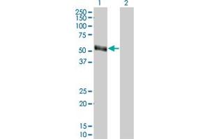 Western Blot analysis of PAX8 expression in transfected 293T cell line by PAX8 monoclonal antibody (M07), clone 1A6. (PAX8 anticorps  (AA 1-450))