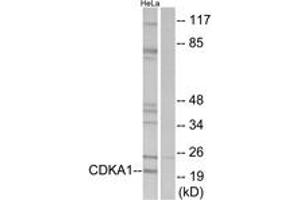Western blot analysis of extracts from HeLa cells, using CDKPA1 Antibody.