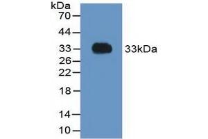Detection of Recombinant F2, Rat using Polyclonal Antibody to Coagulation Factor II (F2) (Prothrombin anticorps  (AA 324-617))