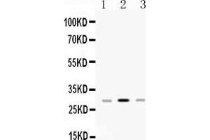 Western blot analysis of HLA-DPB1 expression in rat spleen extract ( Lane 1), mouse spleen extract ( Lane 2) and JURKAT whole cell lysates ( Lane 3). (HLA-DPB1 anticorps  (AA 30-258))