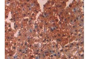 Detection of CA12 in Rat Adrenal gland Tissue using Polyclonal Antibody to Carbonic Anhydrase XII (CA12)