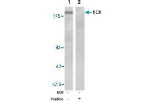 Western blot analysis of extracts from A-431 cells, untreated or EGF-treated (200 ng/ml, 30 min), using BCR polyclonal antibody  .