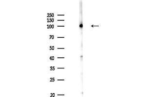 anti-Proteasome (Prosome, Macropain) 26S Subunit, Non-ATPase, 2 (PSMD2) (C-Term) antibody