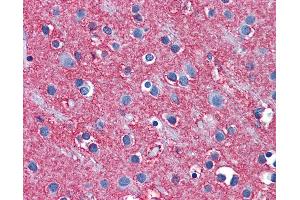 Anti-SLC1A2 / EAAT2 antibody IHC of human brain, cortex.