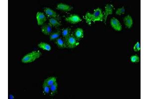 anti-Peroxiredoxin 1 (PRDX1) (AA 1-199) antibody