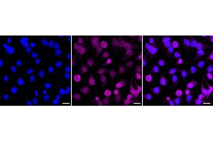 Immunocytochemical staining of Hela cells with TCEB2 antibody (ABIN7800585), 1:1,000).