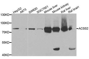 Western blot analysis of extracts of various cell lines, using ACSS2 antibody. (ACSS2 anticorps)