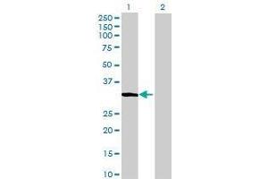 Lane 1: C10orf63 transfected lysate ( 28.