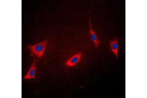 Immunofluorescent analysis of Cyclophilin F staining in K562 cells. (PPIF anticorps  (Center))