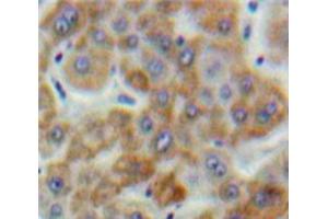 Used in DAB staining on fromalin fixed paraffin-embedded Liver tissue (SSFA2 anticorps  (AA 276-510))
