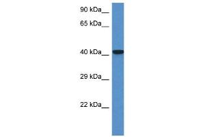 WB Suggested Anti-Zfp759 Antibody   Titration: 1. (Zfp759 anticorps  (N-Term))