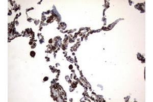 Image no. 1 for anti-Vimentin (VIM) (AA 210-466) antibody (ABIN1491200) (Vimentin anticorps  (AA 210-466))
