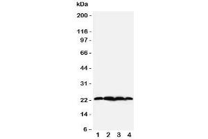 Western blot testing of BAG2 antibody;  Lane 1: rat testis;  2: HeLa;  3: A549;  4: A431 cell lysate.
