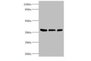 Western Blotting (WB) image for anti-Arginase, Type II (ARG2) (AA 1-354) antibody (ABIN6098038)