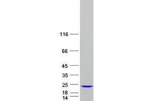 Validation with Western Blot