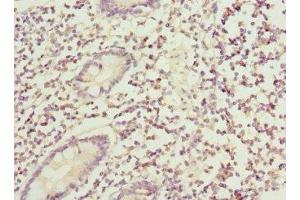 Immunohistochemistry of paraffin-embedded human small intestine tissue using ABIN7145556 at dilution of 1:100 (BFAR anticorps  (AA 1-140))
