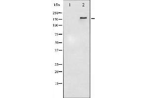 Western blot analysis of HER4 phosphorylation expression in EGF treated HuvEc whole cell lysates,The lane on the left is treated with the antigen-specific peptide. (ERBB4 anticorps  (pTyr1284))