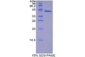SDS-PAGE analysis of Human Lipocalin 12 Protein.