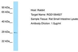 Image no. 1 for anti-TGFB-Induced Factor Homeobox 2 (TGIF2) (C-Term) antibody (ABIN6749857)