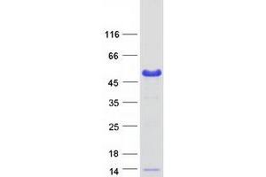 Validation with Western Blot (BCCIP Protein (Transcript Variant B) (Myc-DYKDDDDK Tag))
