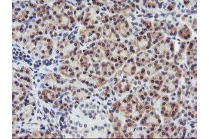 Immunohistochemistry (IHC) image for anti-Adipocyte Plasma Membrane Associated Protein (APMAP) antibody (ABIN1496661)