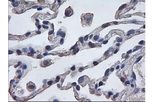 Immunohistochemical staining of paraffin-embedded lung using anti-ERK3 (TA000076) mouse monoclonal antibody.