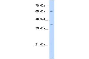 SWAP70 antibody used at 5 ug/ml to detect target protein.