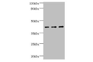 Western blot All lanes: Leukocyte elastase inhibitor antibody at 4 μg/mL Lane 1: MCF-7 whole cell lysate Lane 2: Hela whole cell lysate Lane 3: HepG2 whole cell lysate Secondary Goat polyclonal to rabbit IgG at 1/10000 dilution Predicted band size: 43, 27 kDa Observed band size: 43 kDa (SERPINB1 anticorps  (AA 100-379))