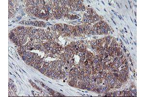 Image no. 3 for anti-Crystallin, Zeta, Homolog antibody (ABIN1497654)