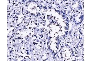 IHC analysis of SUN2 using anti-SUN2 antibody (ABIN7601278). (SUN2 anticorps  (AA 31-695))