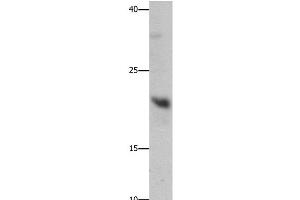 Western Blot analysis of Mouse liver tissue using GFER Polyclonal Antibody at dilution of 1:750 (GFER anticorps)