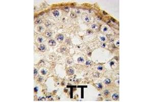 Formalin-fixed and paraffin-embedded human testis tissue reacted with DDX4 antibody (C-term) (ABIN388152 and ABIN2846906) , which was peroxidase-conjugated to the secondary antibody, followed by DAB staining.
