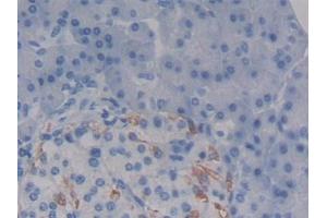 Detection of SDC1 in Human Pancreas Tissue using Polyclonal Antibody to Syndecan 1 (SDC1)