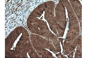 Image no. 2 for anti-Phosphoinositide-3-Kinase, Regulatory Subunit 5 (PIK3R5) antibody (ABIN1500211)