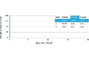 Protein Array (PAr) image for anti-Glutamate Decarboxylase 1 (Brain, 67kDa) (GAD1) antibody (ABIN7456014)