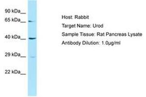 Image no. 1 for anti-Uroporphyrinogen Decarboxylase (UROD) (AA 51-100) antibody (ABIN6749872) (UROD anticorps  (AA 51-100))