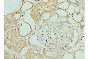 Immunohistochemistry of paraffin-embedded human kidney tissue using ABIN7156393 at dilution of 1:100 (INTS1 anticorps  (AA 451-710))