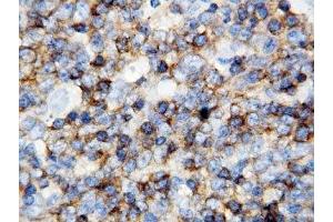 IHC-P: anti-CD45 antibody testing of human tonsil tissue