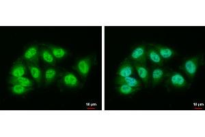 ICC/IF Image DDB1 antibody [N1N3] detects DDB1 protein at nucleus and cytoplasm by immunofluorescent analysis. (DDB1 anticorps)