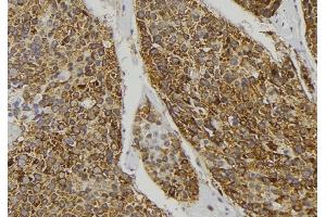 ABIN6278391 at 1/100 staining Human pancreas tissue by IHC-P. (MST1 anticorps  (C-Term))
