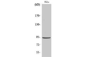 Western Blotting (WB) image for anti-Catenin, beta (CATNB) (Ser29) antibody (ABIN3174194) (beta Catenin anticorps  (Ser29))