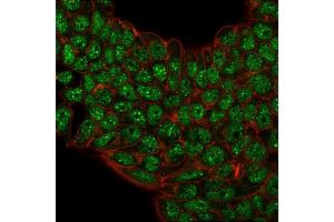 Immunofluorescence staining of paraformaldehyde-fixed MCF-7 cells with SUMO-2/3 Mouse Monoclonal Antibody (SM23/496) followed by goat anti-Mouse IgG-CF488 (Green).