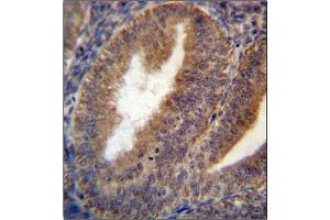 Immunohistochemistry analysis in Formalin Fixed and Paraffin Embedded Human uterus tissue using RRAGC Antibody (Center) followed by peroxidase conjugation of the secondary antibody and DAB staining.