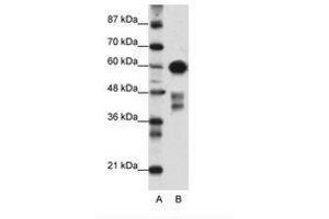 Image no. 1 for anti-Zinc Finger and SCAN Domain Containing 5A (AA 301-350) antibody (ABIN6736156) (ZSCAN5A anticorps  (AA 301-350))