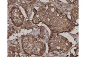 IHC analysis of SNAP23 using anti-SNAP23 antibody (ABIN7599089). (SNAP23 anticorps  (AA 1-211))