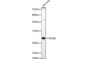 Western blot analysis of extracts of Rat lung, using HOXB5 antibody (ABIN7267769) at 1:510 dilution. (HOXB5 anticorps  (AA 1-170))